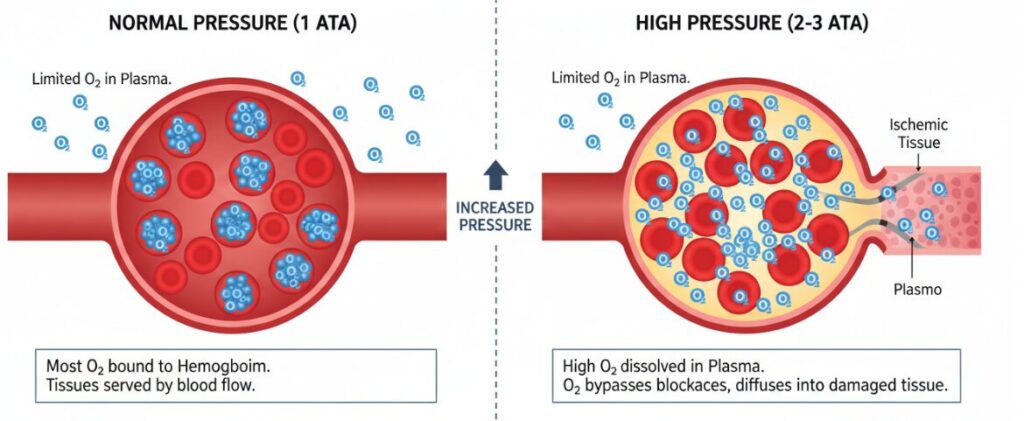 Die Beziehung zwischen Überdruckkammern und Sauerstoff.
