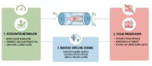 Hyperbaric Oxygen Therapy After Plastic Surgery